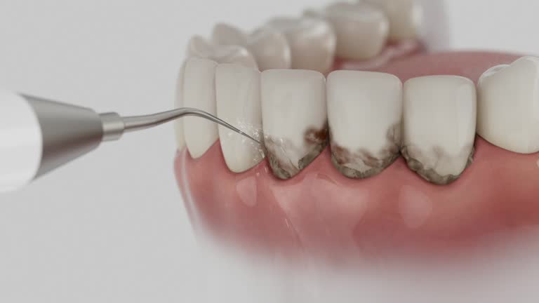 Trusted Emergency Dentist service in Forest Hills, MI - Dentist Open Now